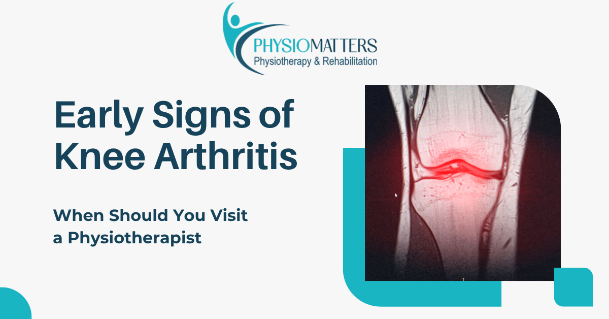 Early Signs of Knee Arthritis Most People Ignore | Physiotherapist in Vashi