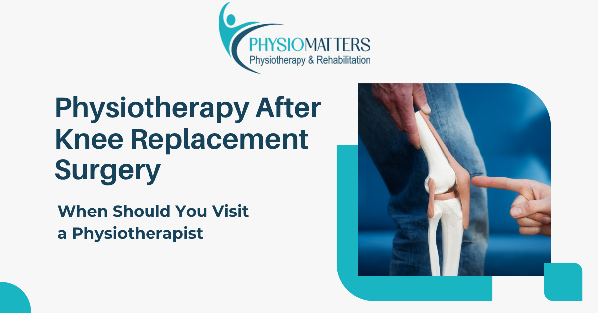 Physiotherapy After Knee Replacement Surgery | Recovery Guide | Physiotherapist in Vashi